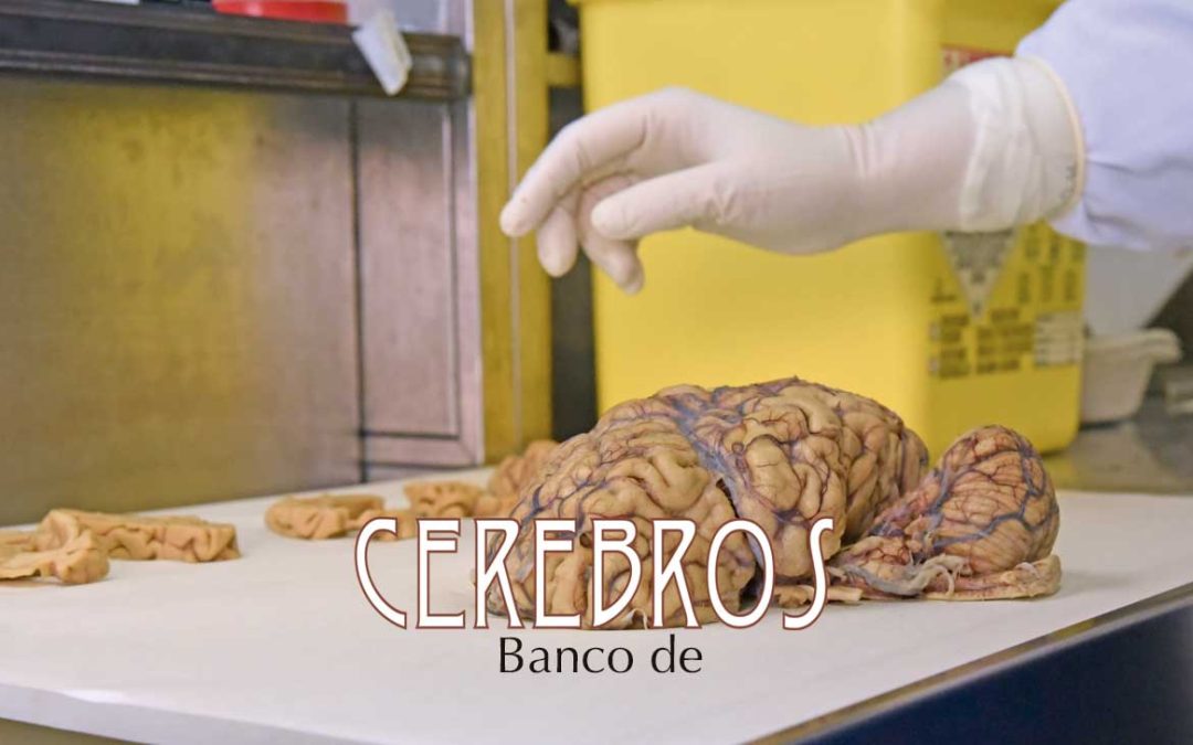 BANCO DE CEREBROS | ¿Habéis pensado en la donación del cerebro?